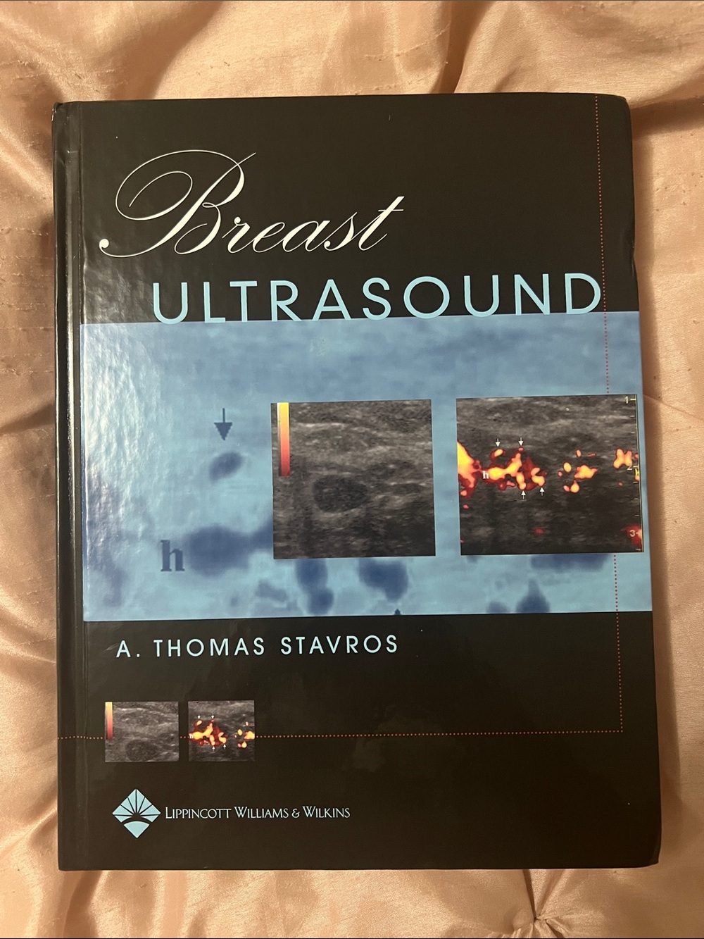 Breast Ultrasound by A. Thomas Stavros MD FACR